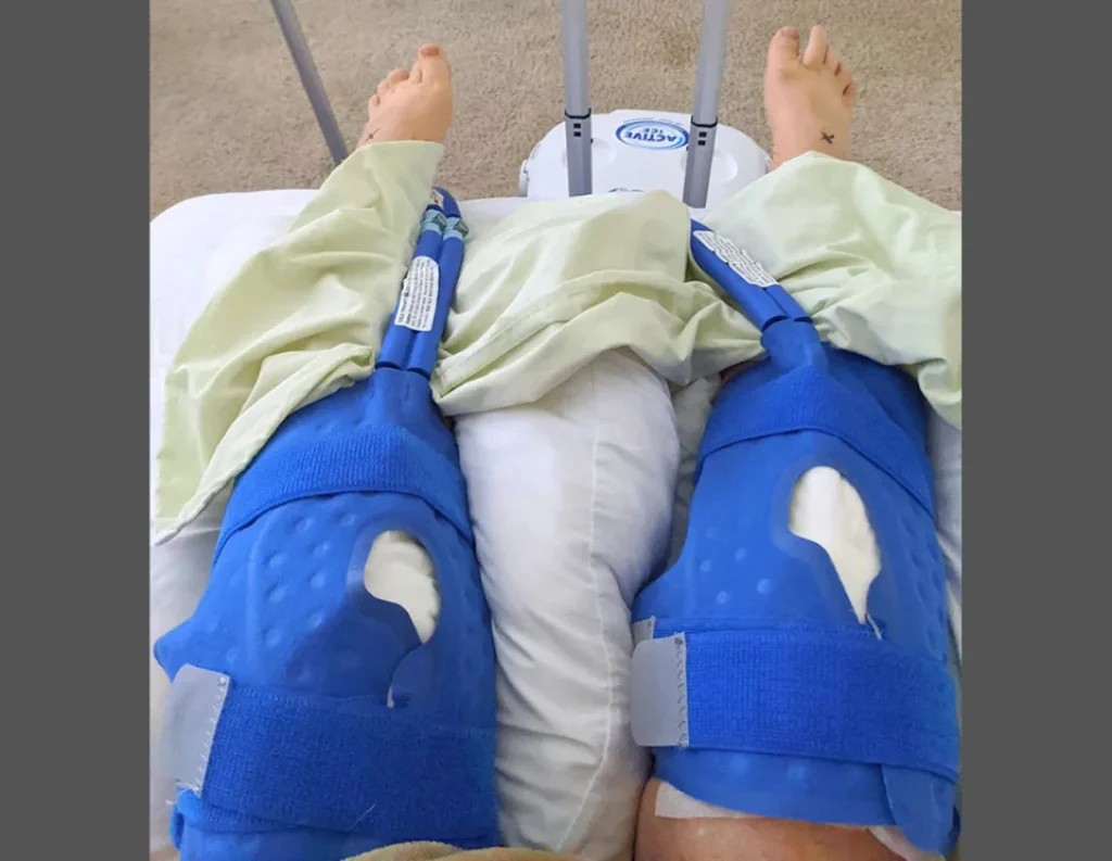 Cryotherapy Pain Relief